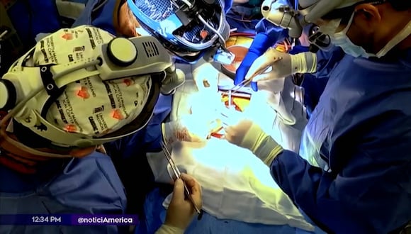 Estados Unidos: falleció receptor del primer trasplante de riñón de cerdo