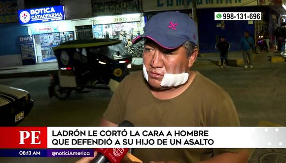 Cortan rostro a hombre que defendió a su hijo de asalto