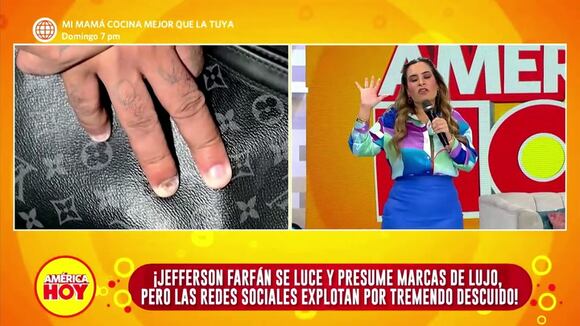 Valeria Piazza broma con dedo dañado de Farfán