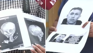 Impactante accidente automovilístico en Comas: bebé de 6 meses queda con muerte cerebral