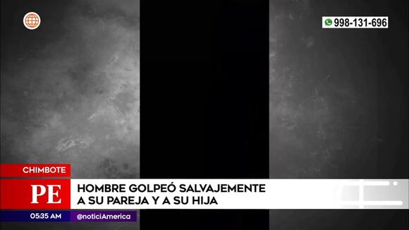 Chimbote: Hombre golpeó salvajemente a su pareja y su hija