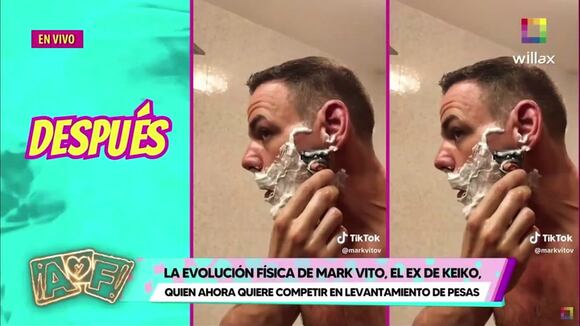 TROME | Mark Vito se habría hecho trasplante capilar, según especialista