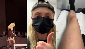 Taylor Momsen, actriz de “Gossip Girl”, fue mordida por un murciélago en pleno concierto