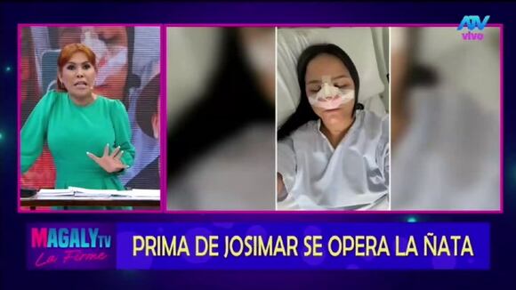 TROME - Magaly pone en duda el embarazo de la 'prima' de Josimar
