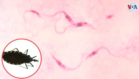 Salud: Enfermedad del Chagas