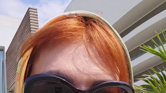 TROME - Magaly muestra cómo sigue su rostro