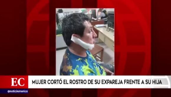 San Juan de Miraflores: Mujer cortó el rostro de su expareja frente a su hija
