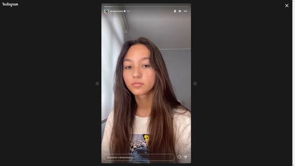 Alexia Barnechea agradece por apoyo que recibe tras hablar de acné