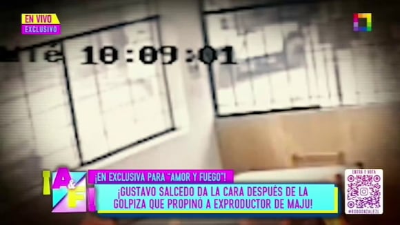 TROME - Gustavo Salcedo rompe su silencio tras agresión
