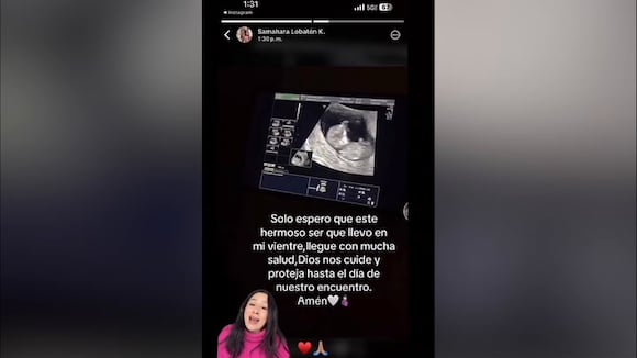 TROME - Samahara Lobatón