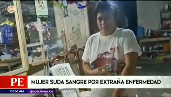 Loreto: Madre de familia suda sangre por extraña enfermedad