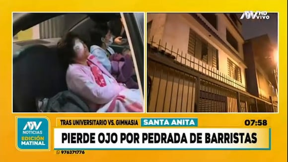 TROME - Abuelita pierde un ojo tras salir de su casa a proteger a sus nietos durante enfrentamiento de barristas de Universitario