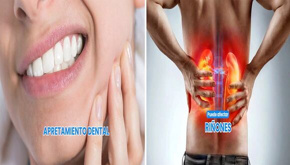 Día de la Odontología Peruana: ¿Cómo afecta a tu cuerpo la mala higiene bucal?