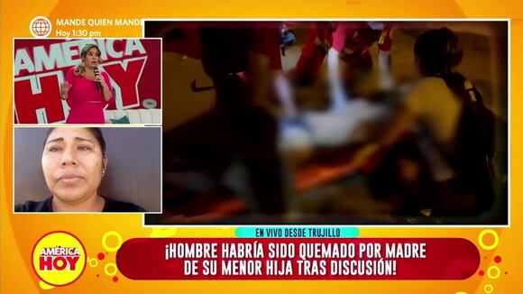 Hombre es quemado vivo por su pareja