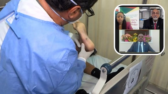 Alerta por viruela símica en África