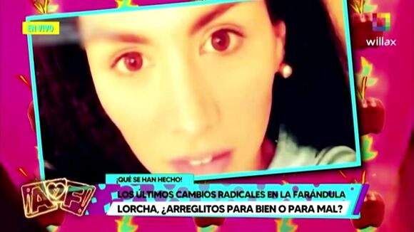 TROME - La Chama Alexandra Méndez y su tremendo cambio físico: “Puro hueso”, opina Gigi Mitre