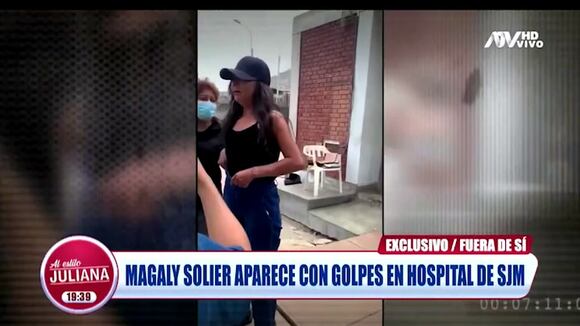 TROME | Magaly Solier aparece con golpes en el rostro en hospital (ATV Al Estilo Juliana)