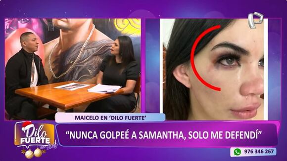 Trome |Jonathan Maicelo dice que fue agredido