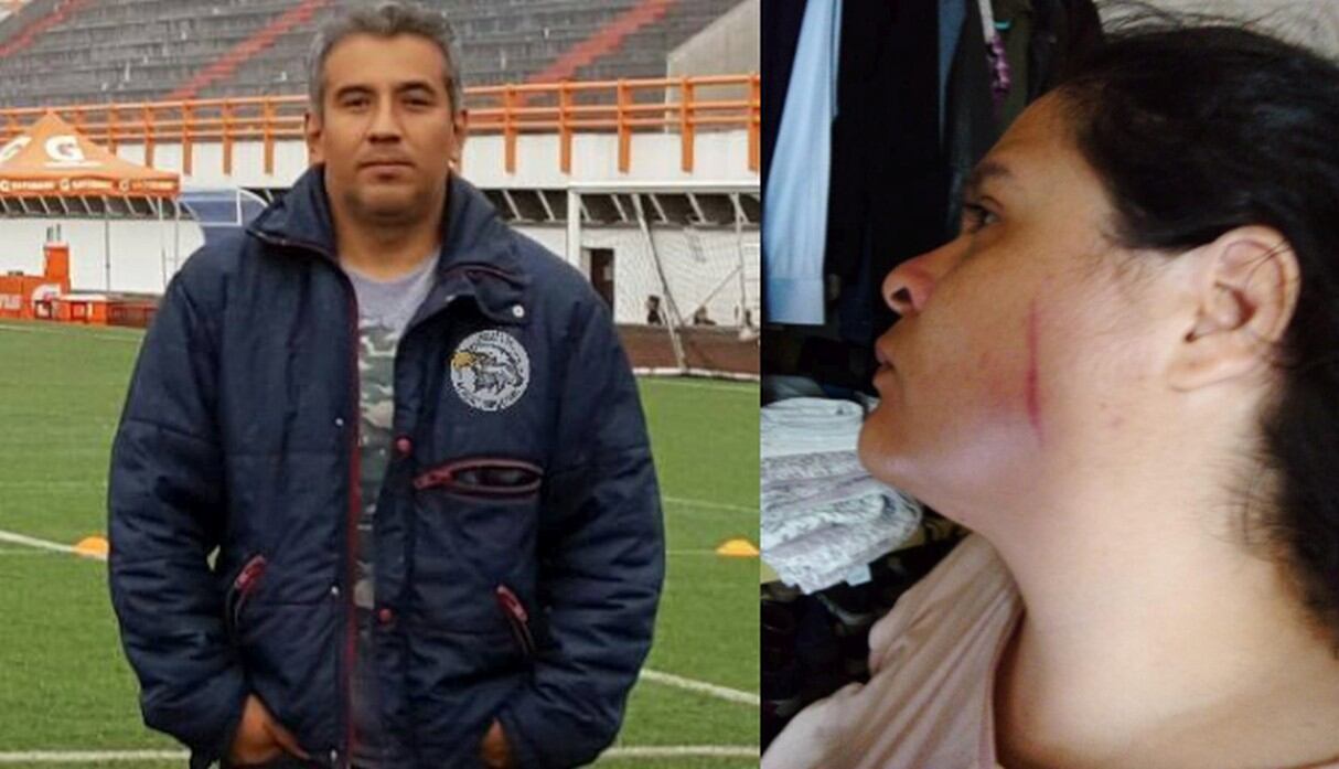 Gabriela Chiappe, periodista de Trome fue brutalmente agredida por Mario Valenzuela Delgado (Fotos: Facebook)