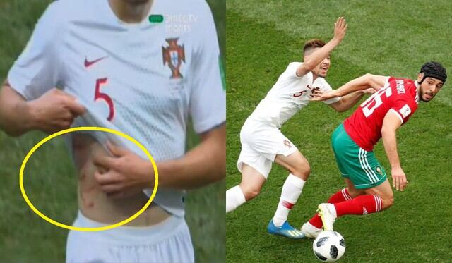 Portugal vs Marruecos: Herido y rasguñado, así quedó el torso de Guerreiro tras pugna en el área VIDEO FOTOS