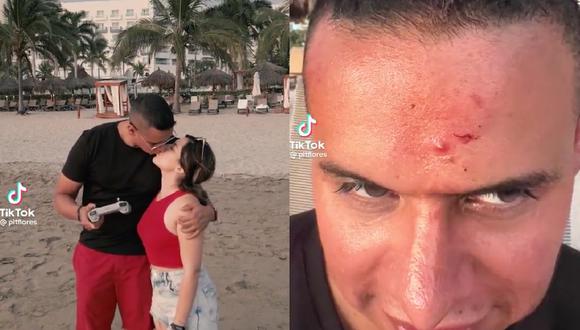 El hombre intentó grabar un video con un dron mientras besaba a su novia en la playa, pero presionó un botón mal y el artefacto se estrelló contra su frente. (Foto: TikTok / @pitflores)