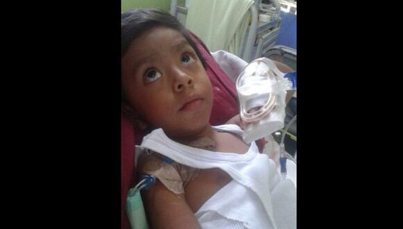 Niño con síndrome de intestino corto necesita ser tratado en Argentina