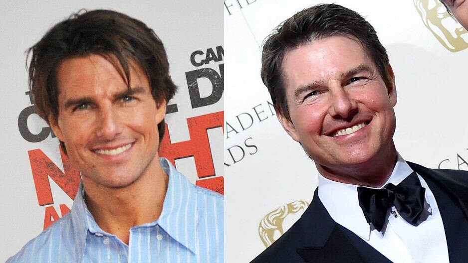 Tom Cruise lució rostro hinchado y enrojecido en los Premios BAFTA (Foto: AFP/EFE)