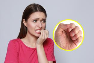 ¿Por qué nos comemos las uñas?, ¿Qué hay detrás de esta conducta compulsiva?