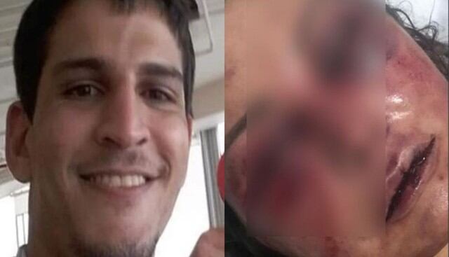 Vinicio Batista Serra, quien dejó con los brazos llenos de golpes y mordiscos a un mujer que conoció por redes sociales, es un agresor en potencia, según las denuncias.